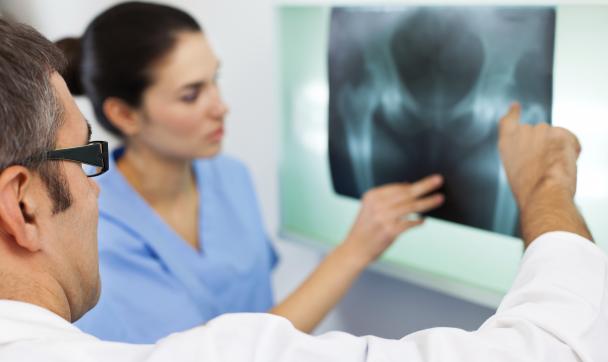 طبيبان ينظران إلى الأشعة السينية