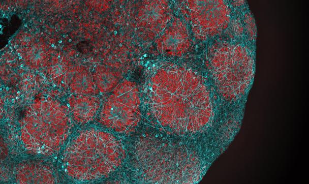 Charité Brain Organoid