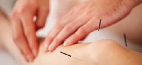 Akupunktur, Naturheilkunde Knie Nadeln abtasten 