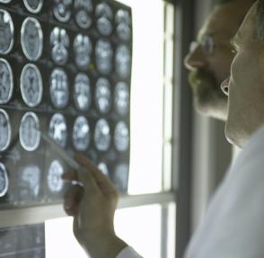 Doctors are analysing magnetic resonance imaging (MRI) scans of the brain