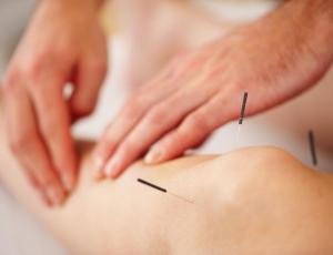 acupuncture, naturopathy knee needles feel 