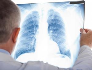 Röntgen Thorax Brust Luftröhre